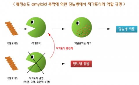 췌장소도 아밀로이드 축적에 의한 당뇨병에서 자가포식의 역할 규명 모식도. 자가포식을 증진시키면(위) 아밀로이드가 제거되고 자가포식이 저하되면(아래) 아밀로이드가 축적되면서 췌장소도세포 사멸과 당뇨병이 유발되는 원리를 이용해 당뇨병 치료의 실마리를 찾을 수 있을 것으로 기대된다. ⓒ 한국연구재단