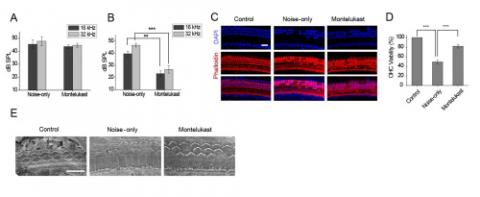 청각세포에서의 몬테루카스트 투여 효과. (A,B) 소음 노출 후 몬테루카스트 투여한 경우와 투여하지 않은 경우 각각에 대해 소음에 대한 뇌간유발반응을 살펴본 결과, 두 경우 모두 일시적 청각손실(A)은 나타나지만 몬테루카스트 투여시 영구적 청각손실(B)은 보호되는 것을 확인할 수 있었다. ⓒ 한국연구재단