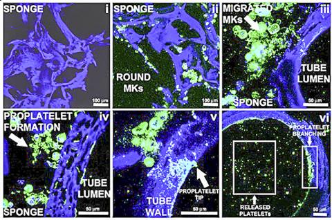 실크 미세관-스폰지 조직시스템 안의 거핵세포들이 혈소판을 생성하는 단계들을 현미경 분석 사진으로 보여준다. ⓒ David Kaplan, Tufts University