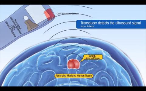 스탠포드대학 전기공학부 연구진이 개발을 앞두고 있는 ‘비접촉 열음파 진단기(noncontact thermoacoustic detection)' 모형도. 초음파를 통해 초기 암 세포에서 새로운 혈관을 생성하는 소리를 탐지할 수 있다.