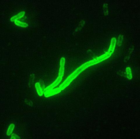 14세기 중엽 유럽에 창궐해 유럽 인구 절반 가량을 죽게한 흑사병균 여시니아 페스트(Yersinia pestis) 바이러스. 과학자들은 DNA 분석 결과를 토대로 이 흑사병균이 서유럽에서 등장해 세계 전역으로 퍼져나갔다고 주장하고 있다. ⓒWikipedia