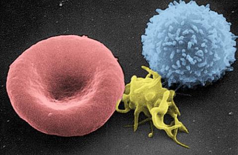 미국 국립보건원(NIH)이 암 환자를 치료하는데 '크리스퍼(CRISPR)' 기술을 적용하는 것을 허용함으로써 유전자가위기술 연구가 활기를 띨 전망이다. 사진은 암 활자를 위한 면역세포를 만들기위해 활용되고 있는 혈구 내 T세포.