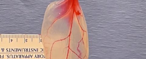 WPI 과학자들이 시금치에 있는 잎맥을 활용해 줄기세포를 모세혈관으로 변환시키는데 성공했다. 그동안 줄기세포의 혈관 분화는 불가능한 일로 여겨져 왔다. ⓒ WPI