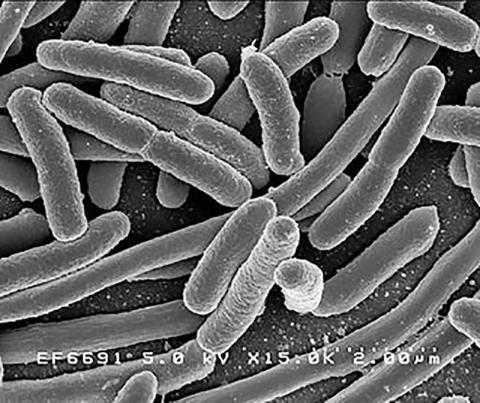 인간의 장 내에 서식하는 대표적인 미생물 중 하나인 Escherichia coli(E-coli) 대장균. Credit: Rocky Mountain Laboratories, NIAID, NIH