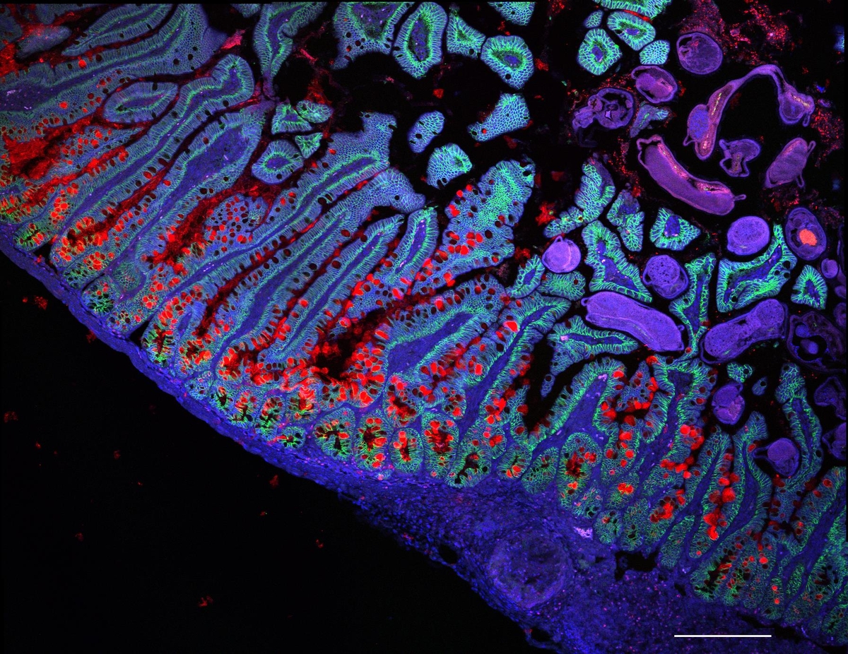 인간 소장 세포 ⓒGrace Burgin, Noga Rogel & Moshe Biton, Klarman Cell Observatory, Broad Institute 제공