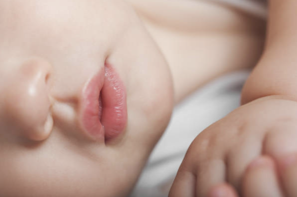 아기의 부드럽고 깨끗한 피부에 갑자기 나타난 붉은 반점이나 부스럼은 초보 부모에게 큰 걱정거리이다. ©Getty Images