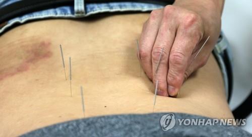 침술 ⓒ연합뉴스 자료사진