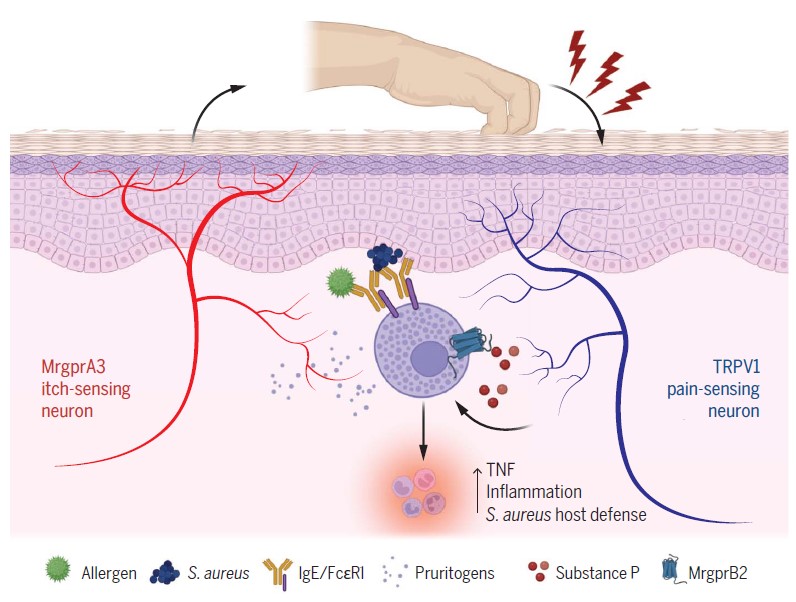 가려움-긁기 반응은 두 개의 분리된 신경세포에 의해 조절된다 ⒸScience