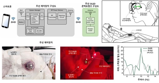 무선 OLED 콘택트렌즈를 활용한 망막전위도 검사 ⓒKAIST 제공