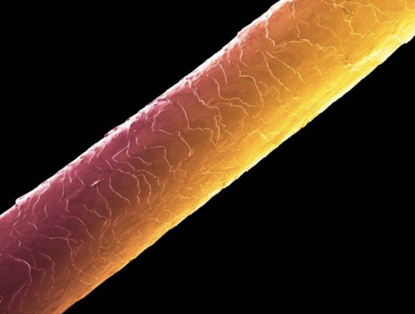 연구진은 케라틴을 이용해 치아 위에 구조화된 생체모방 비계(biomimetic scaffold)를 만들었다. © Getty Images