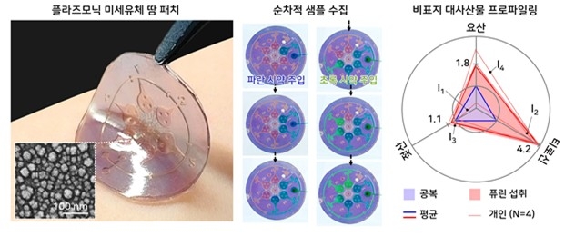 KAIST 연구팀이 개발한 스마트 패치 ⓒKAIST 제공