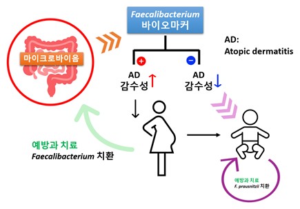 병원성 공생균 마커를 활용한 아토피 피부염 진단 ⓒ김희남 교수 제공