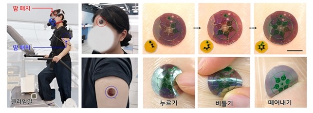 KAIST 연구팀이 제작한 스마트 패치 착용 ⓒKAIST 제공