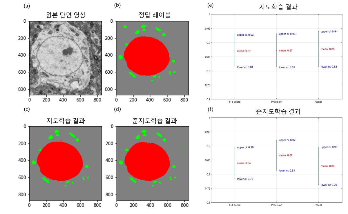 연구팀이 개발한 AI 기반 알고리즘 성능 평가 결과 ⓒ한국표준과학연구원 제공