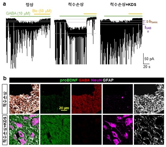 'KDS2010'의 척수손상 회복 효과 ⓒIBS 제공