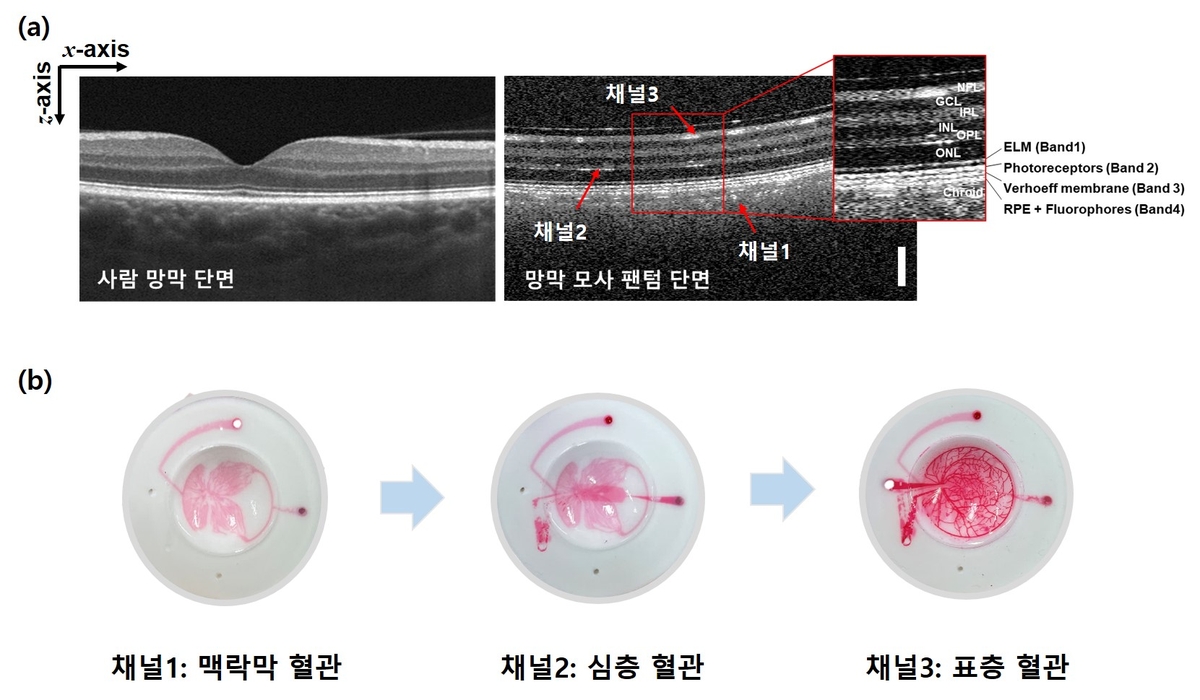표준연이 개발한 안구 팬텀 구조 ⓒ 한국표준과학연구원 제공