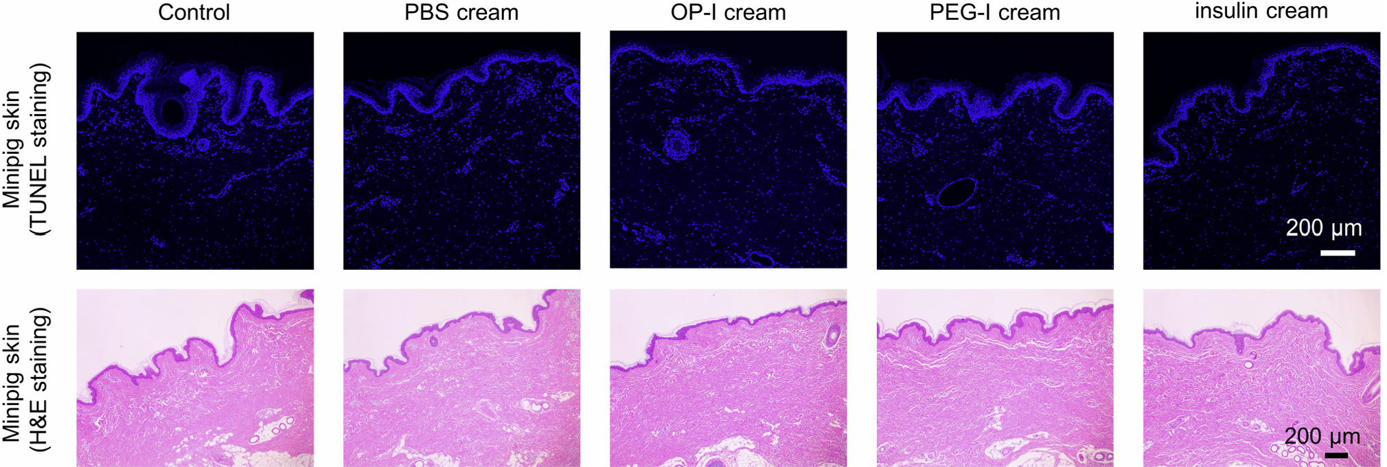 폴리머-인슐린 크림(OP-I cream)을 미니돼지에 바른 후에도 피부 손상이나 염증 반응이 관찰되지 않았다. Ⓒ Nature