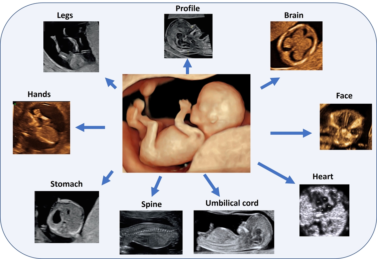 &quot;임신 초기 정기 초음파 검사, 태아 기형 조기 발견으로 이어진다&quot;(Karim JN et al., 2025) ⓒ PLOS Medicine 제공