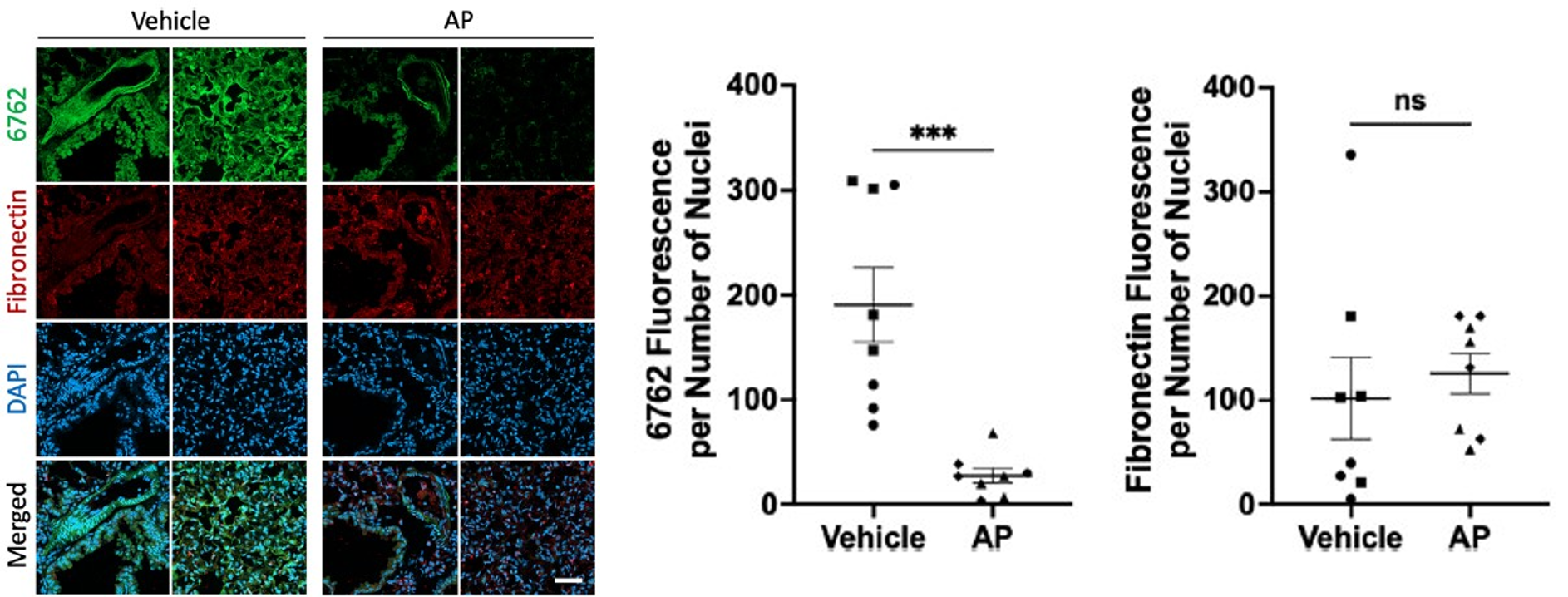 노화 세포가 제거된 마우스에서는 DNA 압타머에 의한 노화 세포 검출이 줄어들었다. Ⓒ Aging Cell
