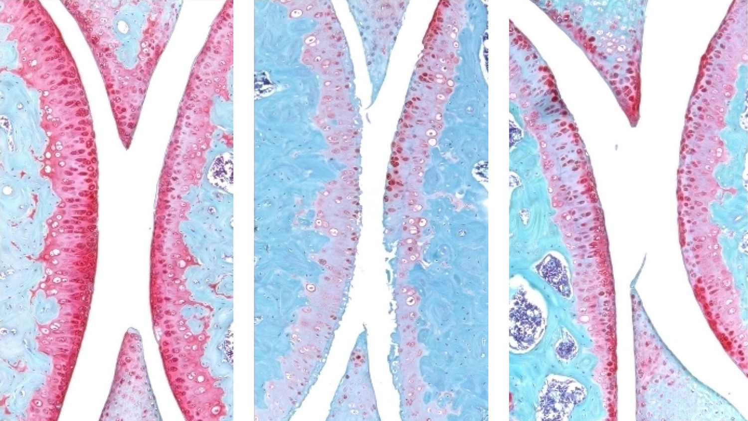 ▲ 젊은 쥐(왼쪽), 노령 쥐(가운데), 그리고 치료를 받은 늙은 쥐(오른쪽)의 무릎 관절. 붉은색은 연골을 나타낸다. ⒸNidhi Bhutani