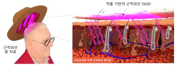 연구결과 모식도 ⓒ 한국과학기술원(KAIST) 제공