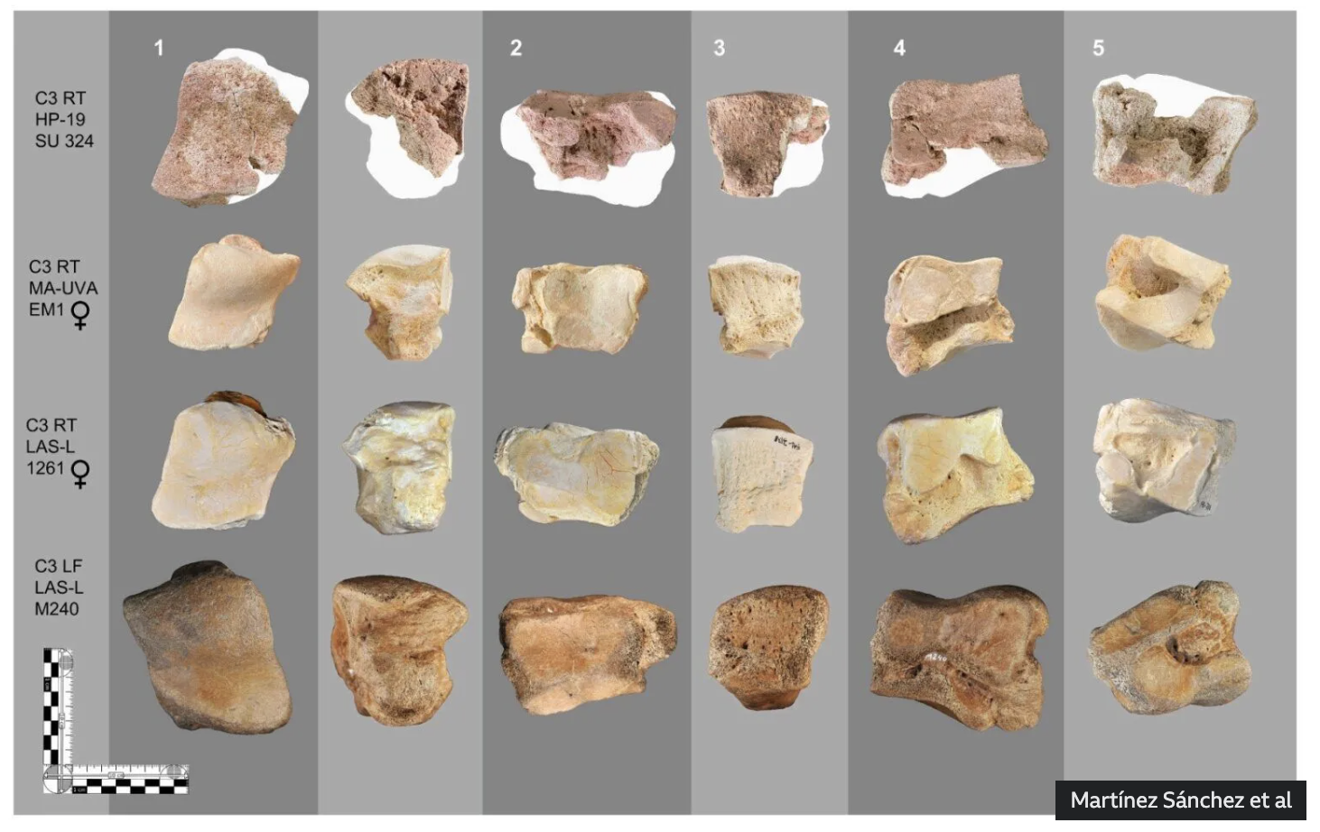 이 뼈에 대해 탄소 연대 측정을 실시한 결과, 기원전 218년경 발발한 제2차 포에니 전쟁 시기와 정확히 일치한다는 사실이 밝혀졌다. ©Martínez Sánchez et al. 2026