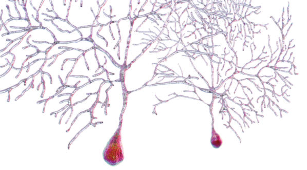 여기서 등장하는 구원자가 바로 억제성 신경세포(Inhibitory neurons 혹은 interneurons)이다. ©Getty Images