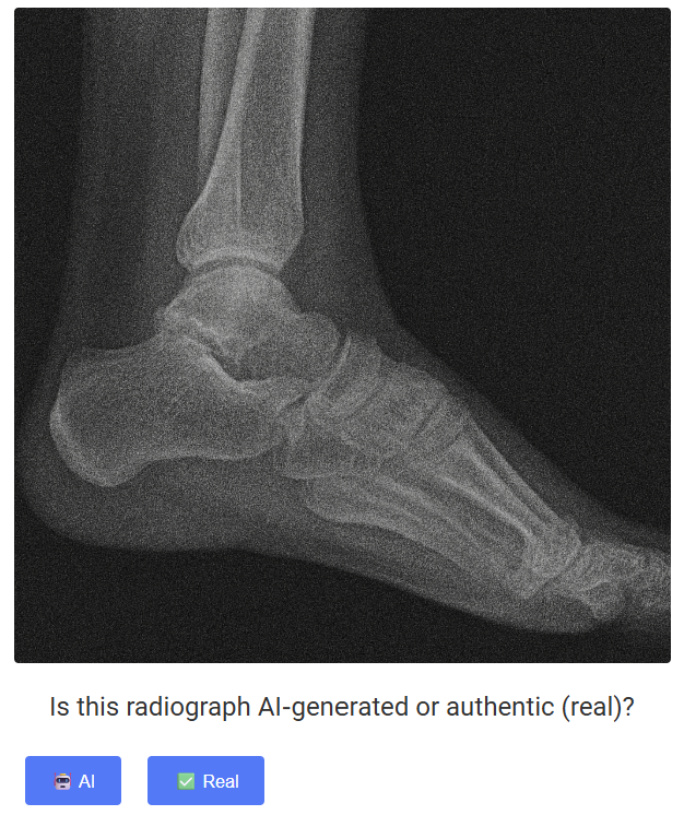 연구팀이 공개한 학습용 딥페이크 X선 데이터 세트를 통하여 진짜와 가짜를 구분해 볼 수 있다. ⒸDeepFakeXRay 웹페이지