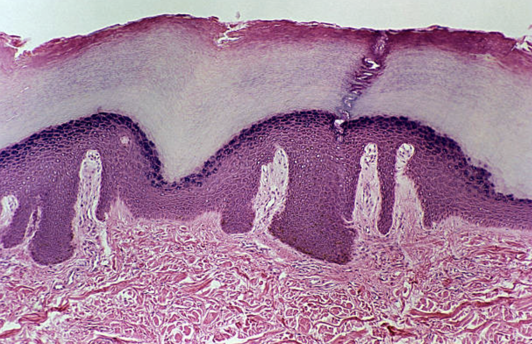 전통적인 서구 화장품은 이 문제를 광물성 오일이나 식물성 오일로 피부 표면을 막는 방식을 통해서 접근해왔다. ©Getty Images
