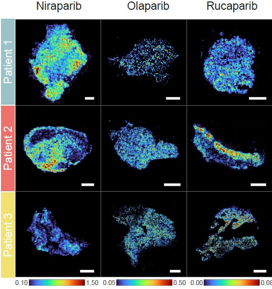 같은 암 조직에서도 5배 이상 약물 농도 차이를 보였다. ⒸNat Commun
