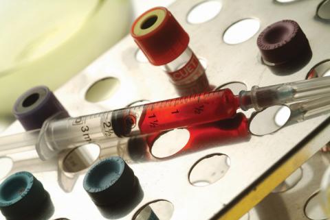 최근 들어 에이즈 완치에 대해 희망과 절망이 엇갈리는 소식이 이어지고 있다. ⓒ ScienceTimes