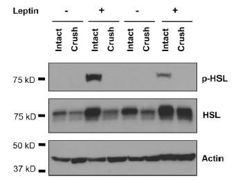 맨 윗줄이 활성화된 지방분해효소(p-HSL)의 양이다. 렙틴을 투여한 경우(Leptin +부분) 중 신경세포가 온전한 경우(Intact)에만 활성화된 효소가 검출되었다. 신경세포에 물리적 손상이 가해진 경우(Crush)에는 활성화된 효소가 검출되지 않았다. ⓒ Zeng et al.