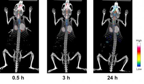 PHMG 흡입 후 각각 30분, 3시간, 24시간이 지난 뒤 얻은 단일광자단층촬영(SPECT)영상. 흰색 화살표는 폐를 뜻한다. 흡입 후 하루가 지났는데도 폐에 다량의 PHMG가 축적돼 있는 것을 확인할 수 있다. ⓒ 한국원자력연구원