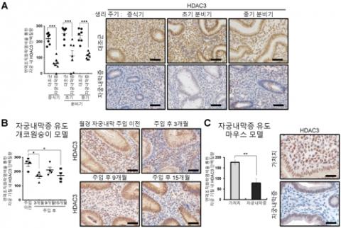 자궁내막증 환자(A), 개코원숭이(B), 쥐(C)의 자궁 내막 조직에서 HDAC3 단백질량이 감소한다는 것을 면역조직 화학염색(Immunohistochemistry)으로 확인한 결과 ⓒ 한국연구재단 제공