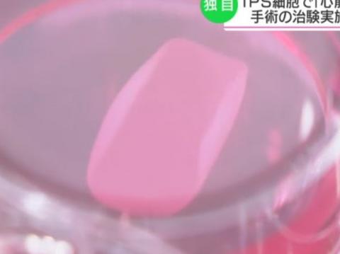 iPS로 만든 시트 모양의 심장근육세포  ⓒ NHK 캡처