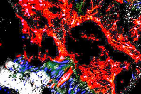 혈관 석회화의 주범은 줄기세포