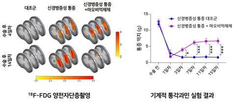 모노아민 산화효소 B(MAOB) 억제제에 의한 신경병증성 통증 치료 효과. 신경병증성 통증 모델 생쥐에 GABA를 생성하는 핵심 효소인 MAOB를 억제하는 약물을 투여하면 2주 만에 신경세포의 '지속적 흥분'이 억제돼 포도당(18F-FDG) 대사가 정상 수준으로 회복된다는 사실이 양전자 단층촬영(PET)으로 확인됨(왼쪽). 또 기계적 통각과민 측정 실험 결과 MAOB 억제제를 투여하면 신경병증성 통증 모델의 통증역치가 1~2주 안에 유의하게 회복되는 것으로 확인됨. ⓒ한국과학기술연구원 제공
