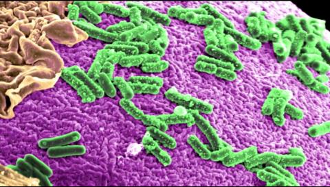 미국 메릴랜드의대 연구진은 최근 장(腸) 내의 활생균(probiotic)이 장 안의 여러 세균을 번식토록 하는 역할을 해 장의 생태계에 영향을 미친다는 연구 결과를 발표했다. 사진은 장 박테리아의 현미경 사진 ⓒ UM SOM