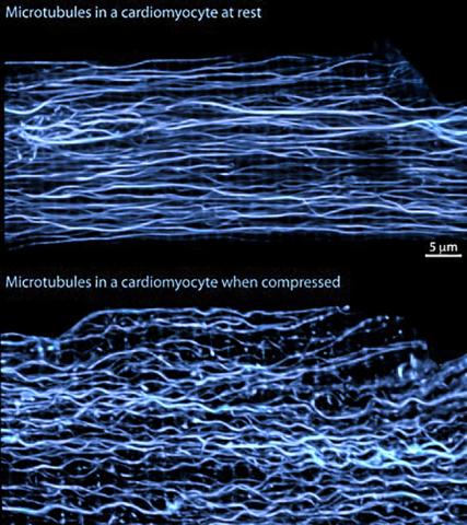 심장이 쉬고 있을 때(위)와 수축했을 때(아래) 심근세포에 있는 미세소관의 모습을 현미경으로 포착했다.<BR> The lab of Ben Prosser,<BR> PhD,<BR> Perelman School of Medicine,<BR> University of Pennsylvania ⓒ ScienceTimes