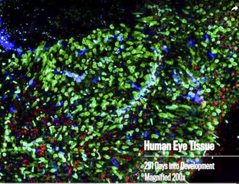 실험실에서 배양 291일째의 망막 조직. 동영상 캡처. CREDIT: Len Turner and Dave Schmelick/JHU