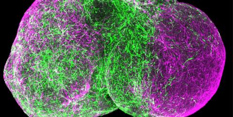 스탠포드대학의 파스카 박사팀이 배양한 티모시 증후군을 가진 인간 피질 타원체(human cortical spheroids, hCSs). ⓒ www.stanford.edu/PASCA LAB