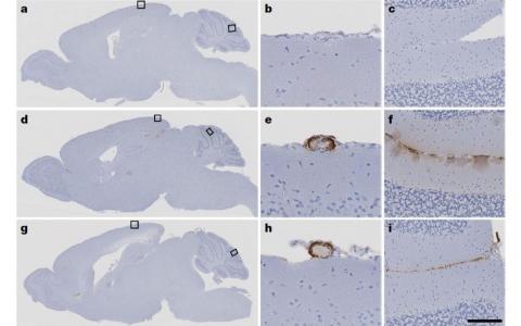 연구에 활용된 실험용 쥐의 뇌 부위. 윗줄은 합성 성장호르몬을 주사한 대조군, 아래 두 줄은 사체의 뇌하수체 유래 인간성장호르몬(c-hGH)을 주사한 군이다. E와 h는 뇌 아밀로이드 혈관병증(CAA), f와 i는 베타-아밀로이드 침착을 나타낸다.  Source: Purro et al, 2018
