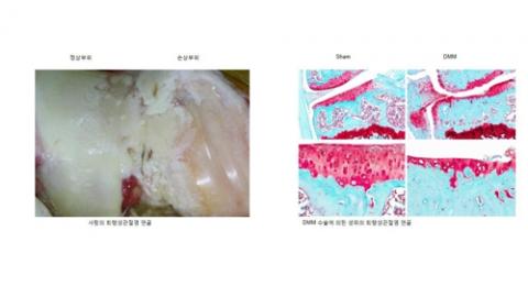 퇴행성관절염의 퇴행연골 이미지 (왼쪽) 사람의 퇴행성관절염 연골. 사진의 왼쪽 부위는 정상연골이 남아 있고 오른쪽 부위는 연골이 완전히 마모되어 아래쪽 뼈가 노출되어 있다. (오른쪽) 생쥐모델의 퇴행성관절염. 생쥐에서는 DMM 수술로 사람의 경우와 유사한 퇴행성관절염을 유도할 수 있다. 대조군(Sham)에서는 적색으로 나타난 온전한 연골조직이 보이나 DMM 수술을 한 경우 연골조직이 파괴되어 있음을 볼 수 있다