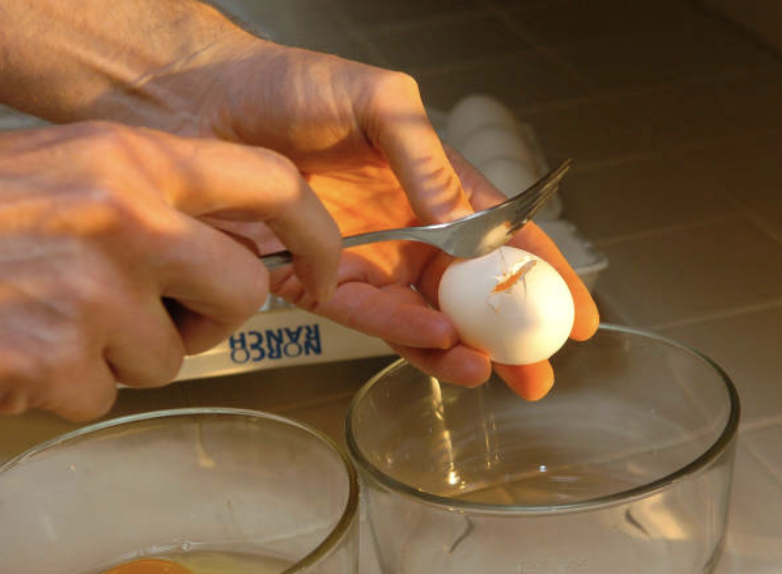 파킨슨병, 증상이 나타나기 수십년전에 알 수 있다면