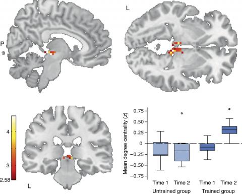 성인 문맹자에게 글을 가르치면 뇌의 백질 및 뇌간, 시상까지 변화시킨다는 연구결과가 발표됐다. ⓒ 막스플랑크 뇌과학연구소