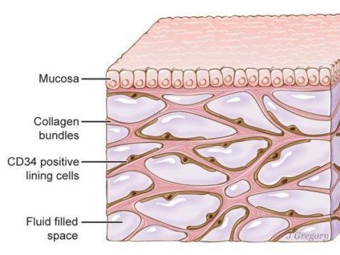 피부 아래의 사이질 조감도. Credit: Illustration by Jill Gregory. Printed with permission from Mount Sinai Health System, licensed under CC-BY-ND.