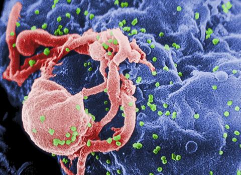 배양된 백혈구에서 HIV-1 바이러스가 자라나고 있는 모습을 전자현미경으로 촬영했다. Credit: CDC/ C. Goldsmith, P. Feorino, E. L. Palmer, W. R. McManus
