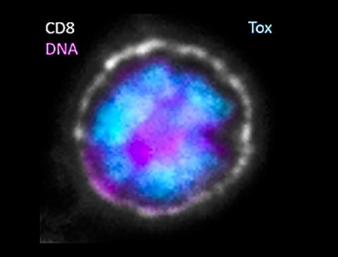 탈진한 CD8 T세포의 핵에서 Tox 단백질이 기능하고 있는 모습. 흰색은 CD8 T세포 표면의 염색된 부분, 핑크색은 핵에 있는 DNA, 파란색은 핵에 있는 Tox 단백질을 나타낸다. Credit: John Wherry, Penn Medicine