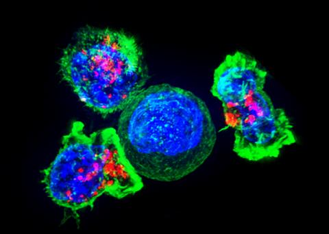 암세포를 둘러싼 세포 독성 T세포 그룹의 고해상도 이미지. Credit: Wikimedia / NIH