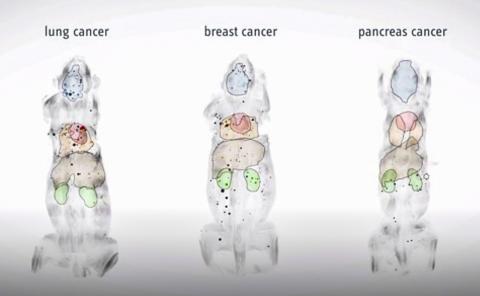 쥐에서 폐암과 유방암, 췌장암이 전이된 모습. 동영상 캡처. ©Helmholtz Zentrum München